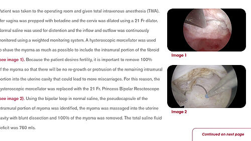 Princess Case Report