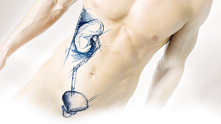 Urologic surgery next 8. 陰茎・陰嚢・アンドロロジー メジカルビュー社｜泌尿器科｜Urologic Surgery Next 8 陰茎・陰嚢