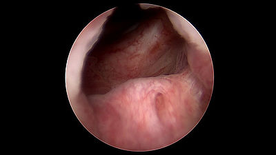 Endobild Cystoskopie Endobild Cystoskopie
